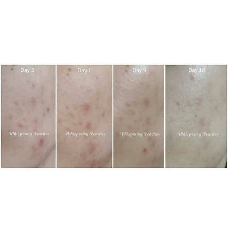 [HCM]Nước hoa hồng Cosrx AHA/BHA Clarifying  Toner