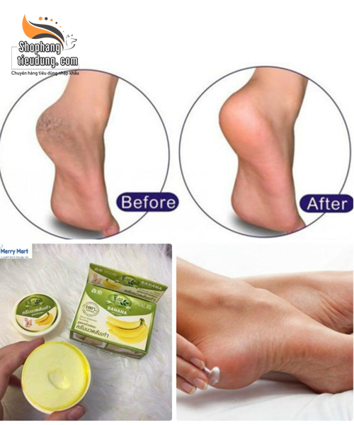 Kem Khử Nứt Gót Chân Chuối Banana Thái Lan