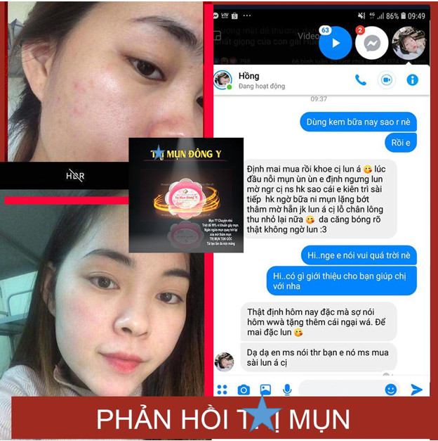 [HCM]Kem sạch mụn đông y hoa anh đào