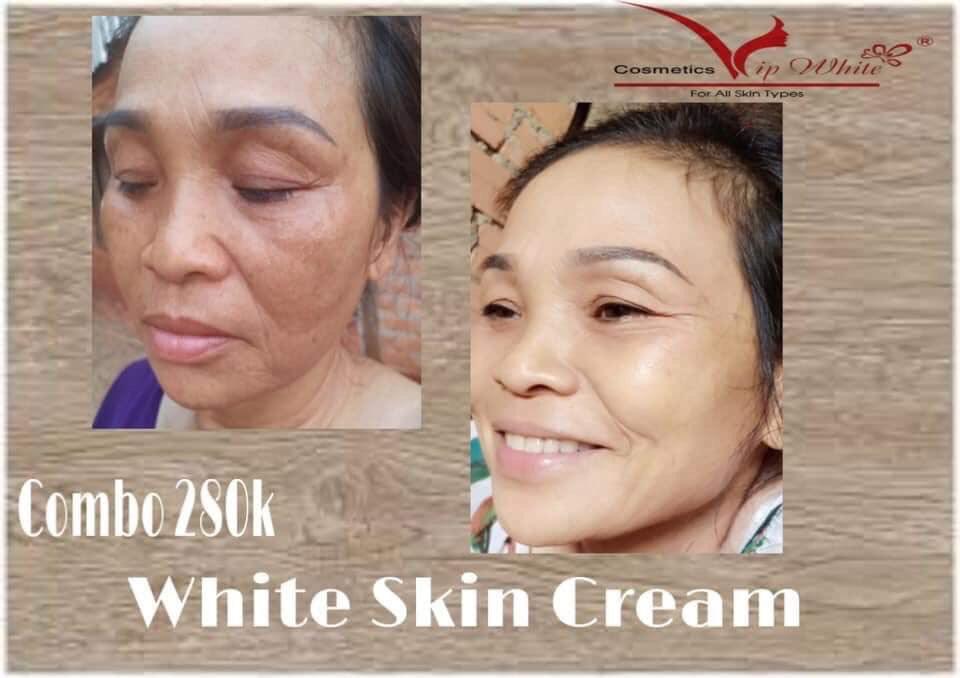 Kem dưỡng da vip white