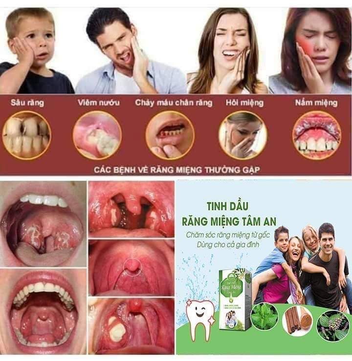 Tinh Dầu Răng Miệng Tâm An 15ml