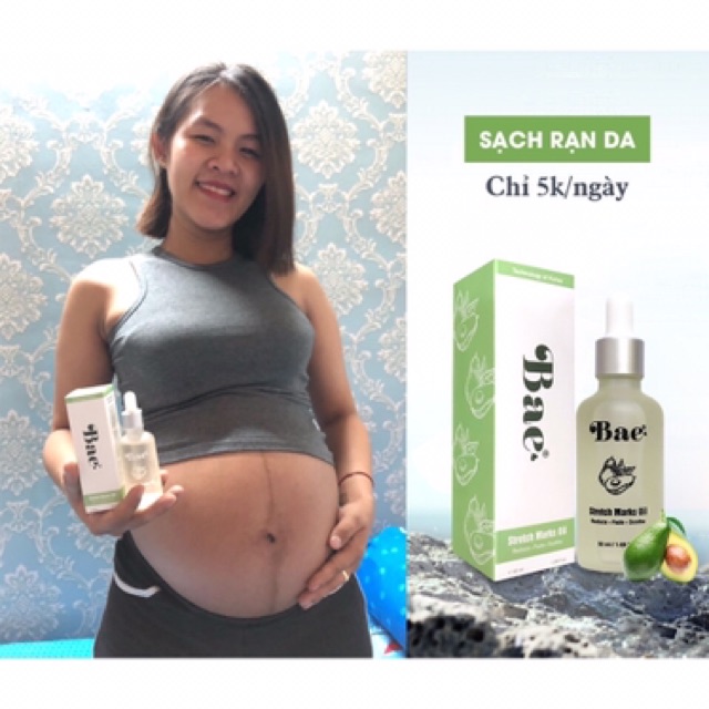 Dầu Cho Rạn Da Sau Sinh Bae 50ml - Mẫu mới