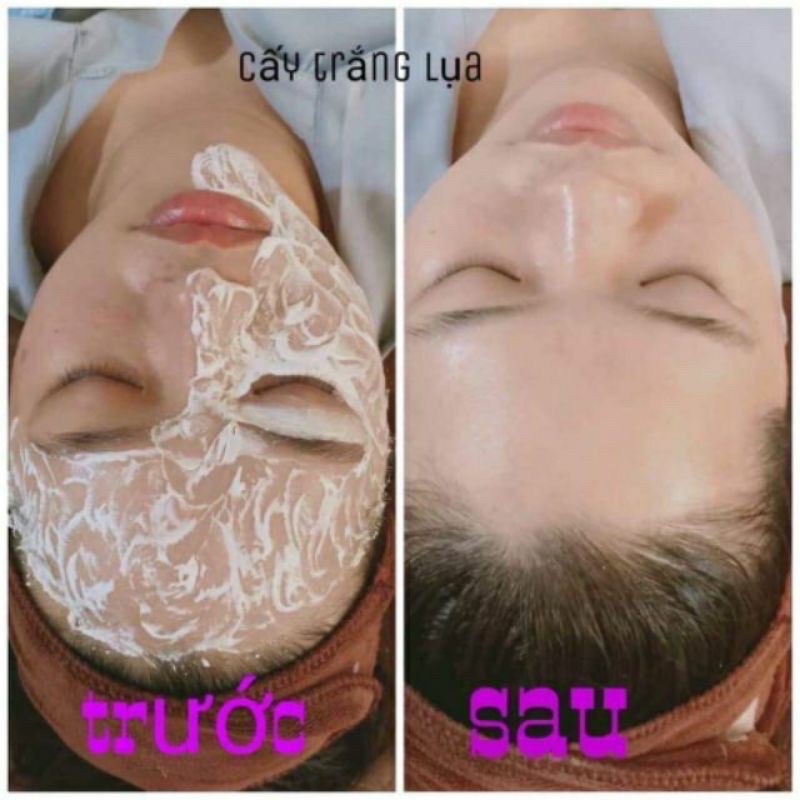 Cấy Trắng Lụa Nano Collagen Tại Nhà Và Spa