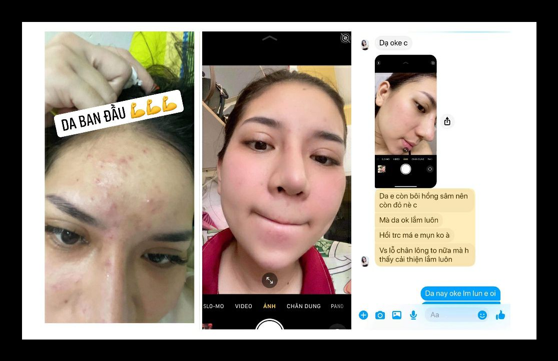 HỒNG SÂM TÁI TẠO DA ( Chính Hãng 100%)