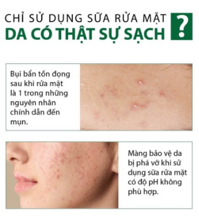 Mặt nạ Diếp Cá dưỡng ẩm trắng da 50g