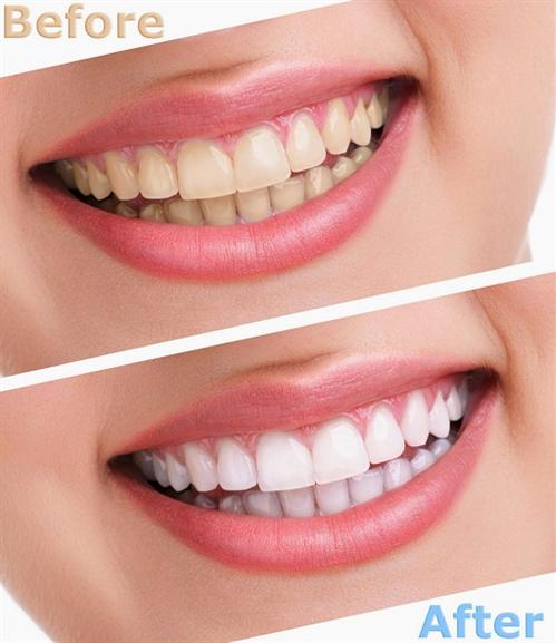 Kem đánh trắng răng Eucryl Freshmint Toothpaste Anh Quốc 62g [Đá dán răng 2D]