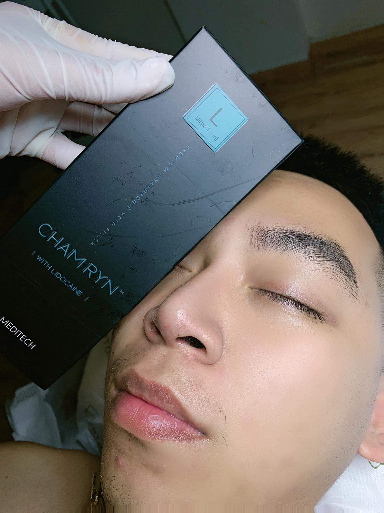 FILLER CHAMRYN HÀN QUỐC 1 HỘP 1CC