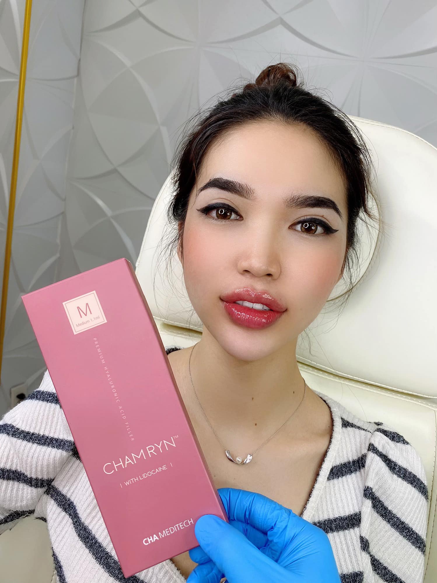 FILLER CHAMRYN HÀN QUỐC 1 HỘP 1CC