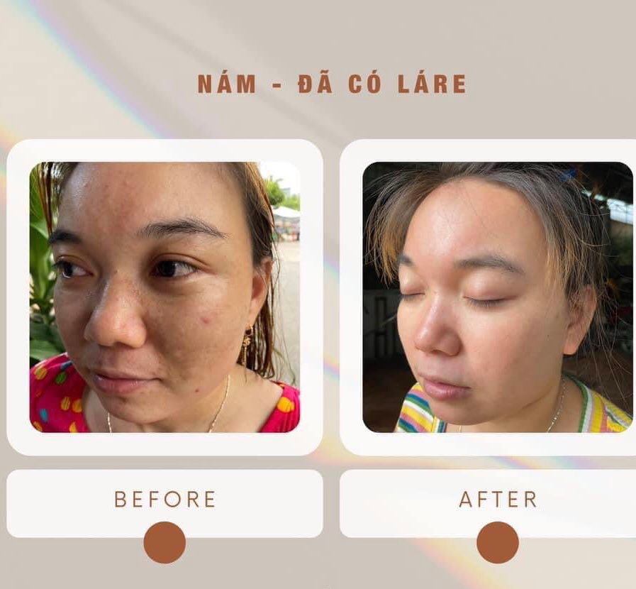 Serum thảo mộc thanh dược Lare chiết 10ml