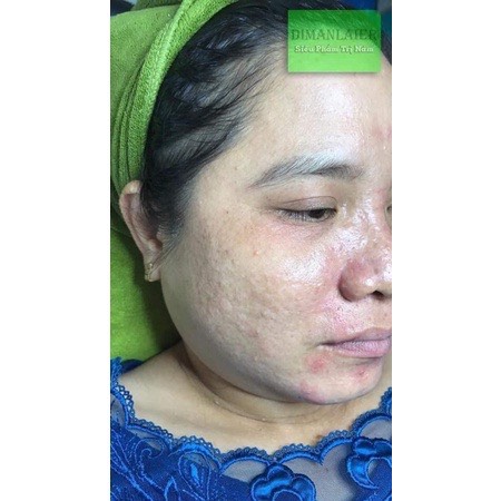 Tinh dầu cấp ẩm căng mướt da Tam Bảo Sắc 30ml - (Hồng Kông)