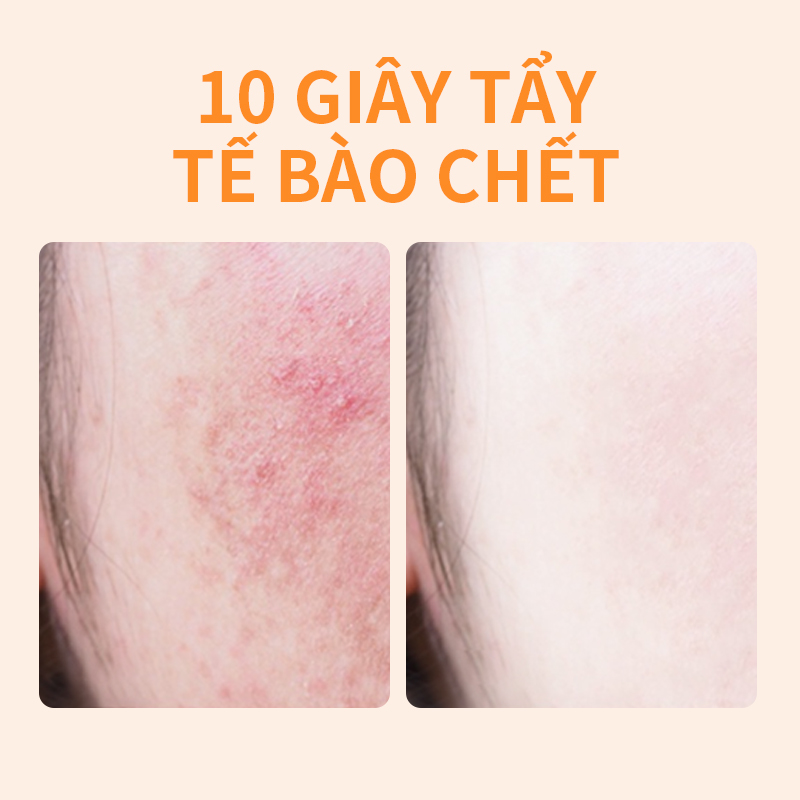 Tẩy Tế Bào Chết Da Mặt Dịu Nhẹ GAMELAN Exfoliate Gel Làm Trắng Da Sạch Sâu Lỗ Chân 50g