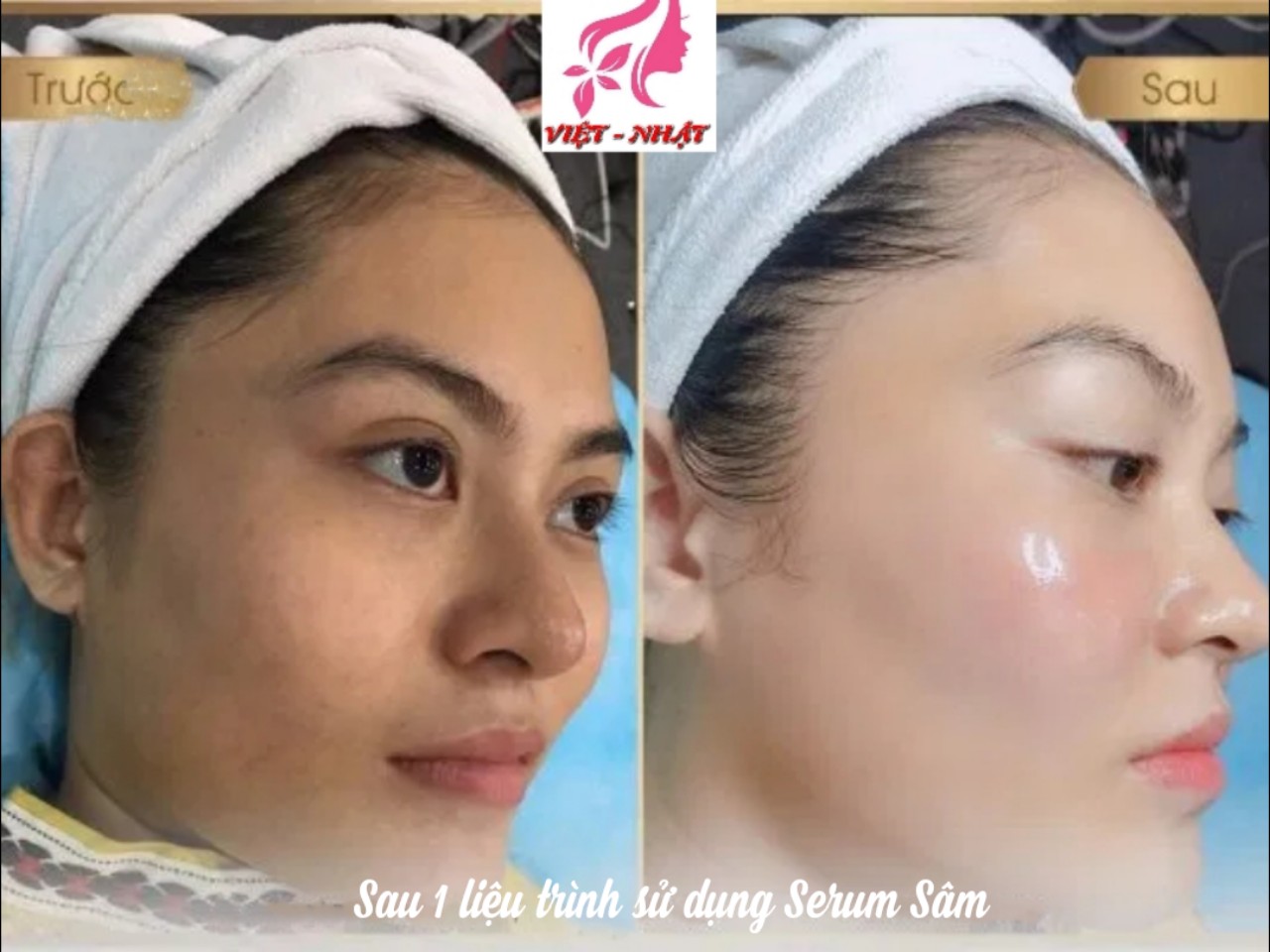 Serum sâm dưỡng da trắng căng bóng