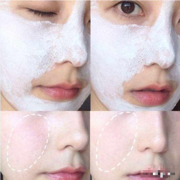 Mask đất sét Kieo Rare Earth - Hũ Chiết