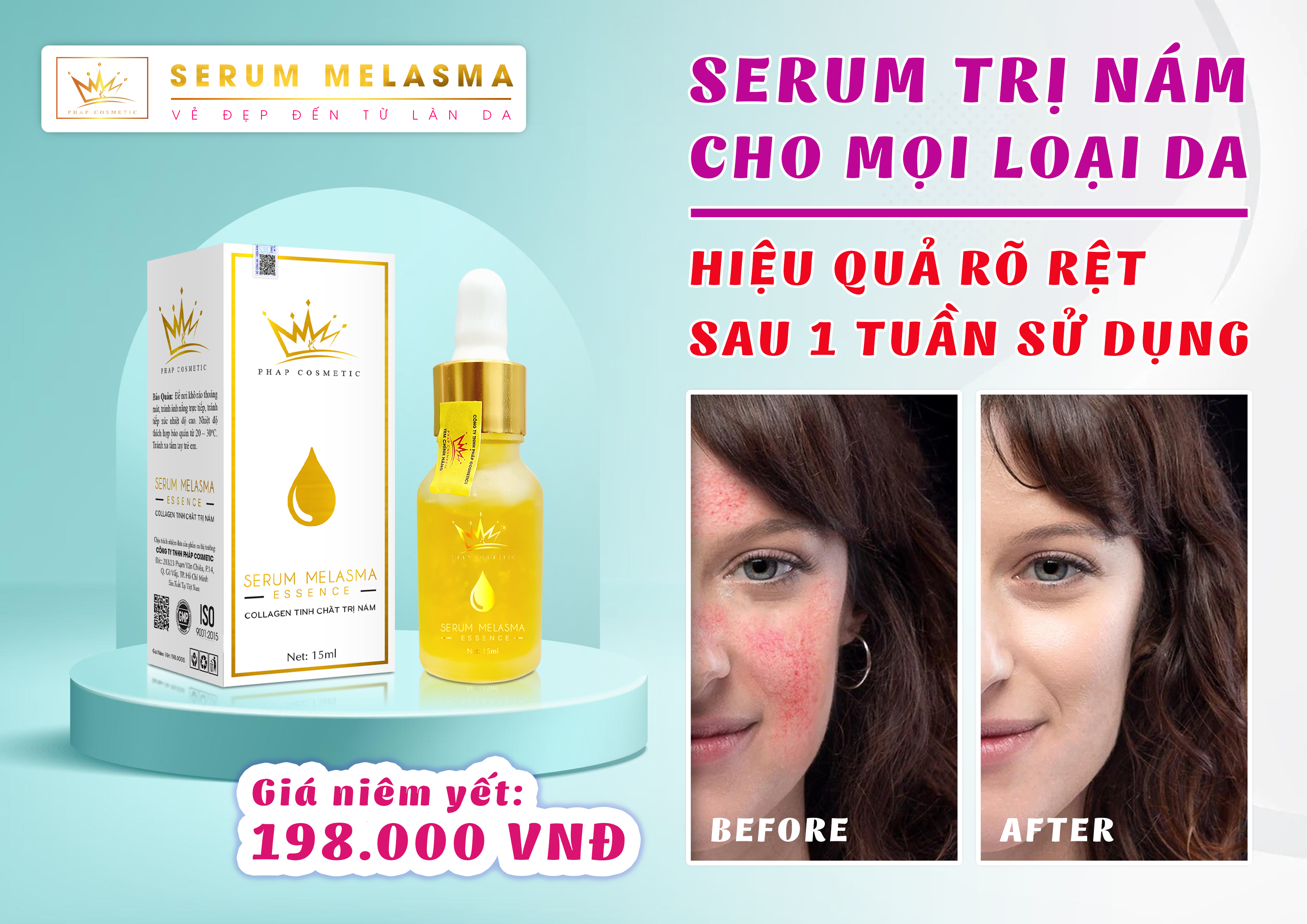 SERUM PHÁP NÁM MELASMA