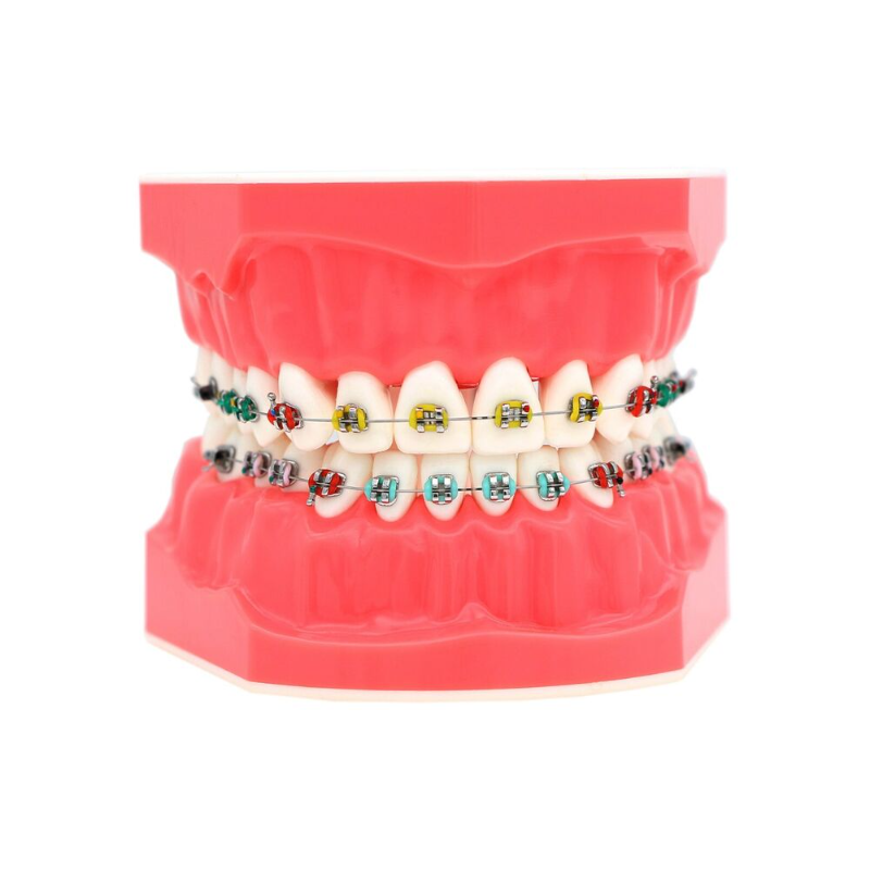 Trong kho nha khoa chỉnh nha mô hình với khung vòm dây ligature Tie 1 1