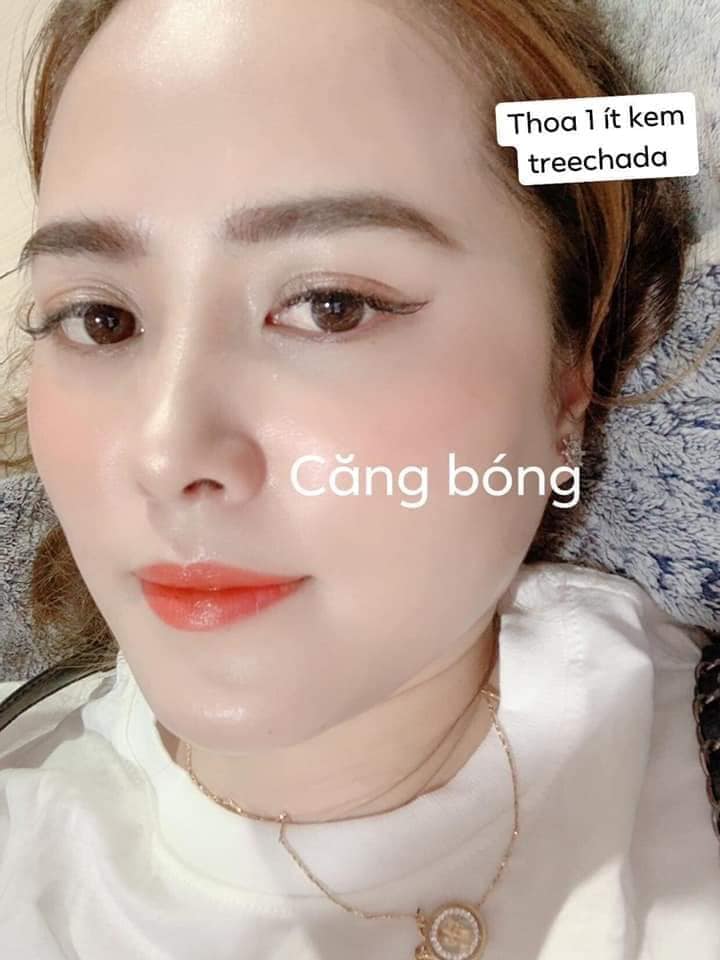 Kem TREE CHADA Thái Lan