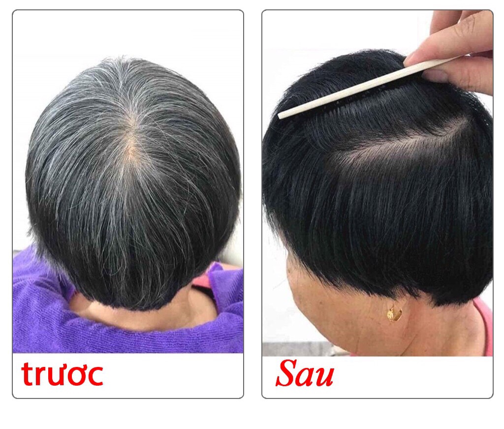 Nhuộm Đen Không Dính Da Đầu keratin 500ml x 2