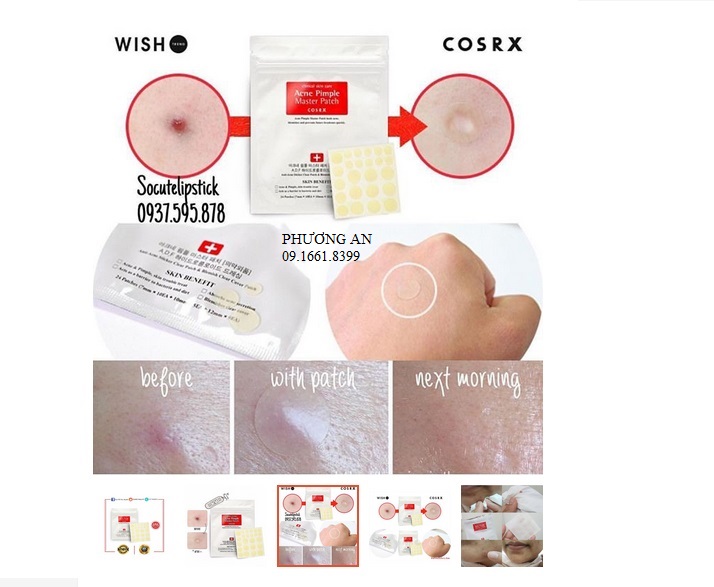 Miếng Dán Mụn Corsx - Acne Pimple Master Patch Cosrx CHÍNH HÃNG