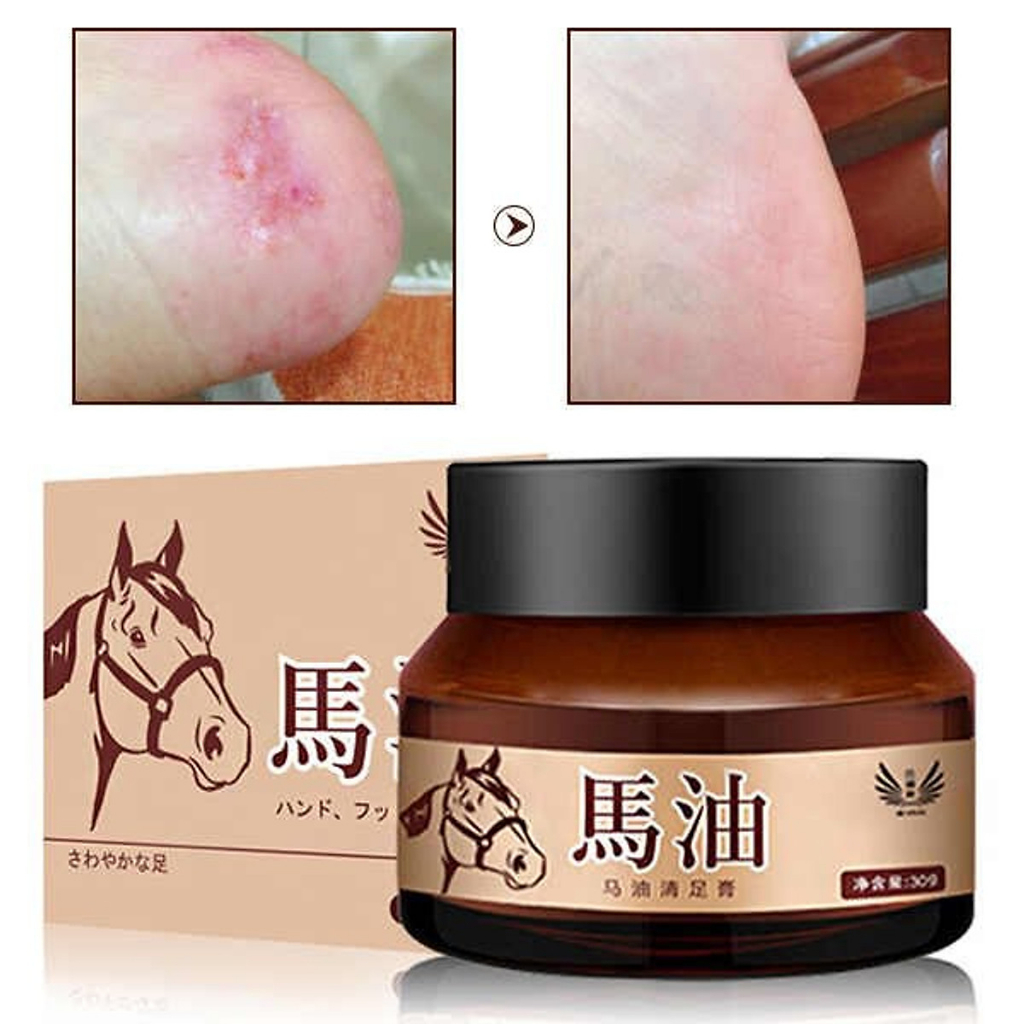 Kem Dầu Ngựa Bôi Nứt Gót Chân (Nội Địa Trung)