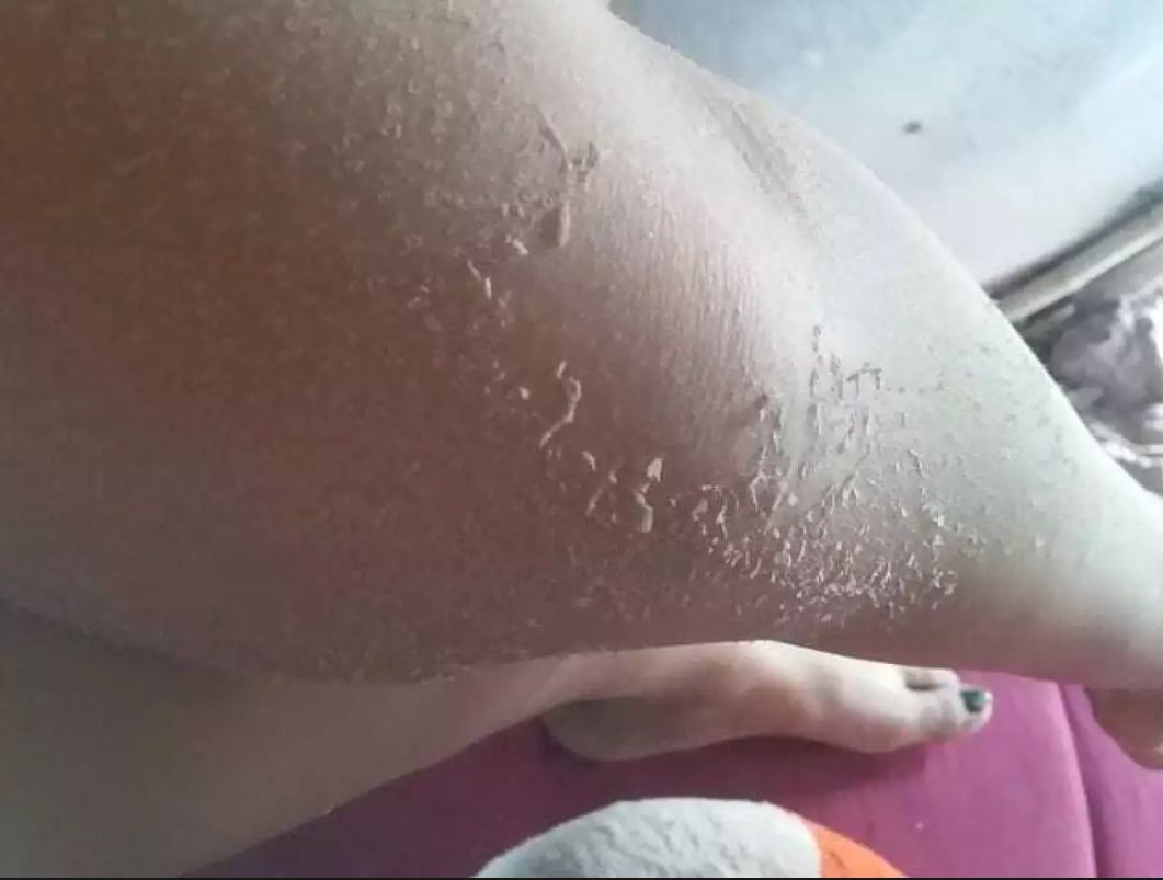 200gr kem bong da tái tạo body