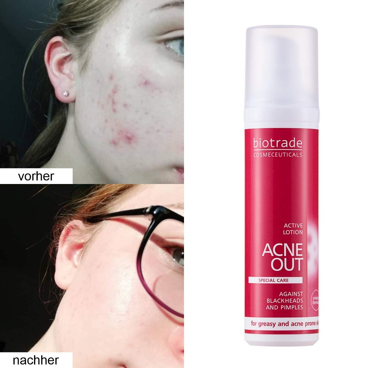 [HÀNG CÔNG TY] Chấm Mụn Biotrade Acne Out Active Lotion