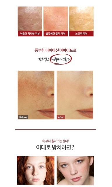 Kem Đặc Trị Melasma-X 3D Whitening Clinic