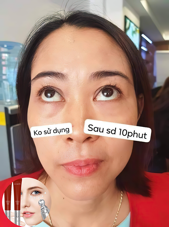 [HCM]Gel Xóa Nhăn Xóa Thâm Quầng Mắt MERIC