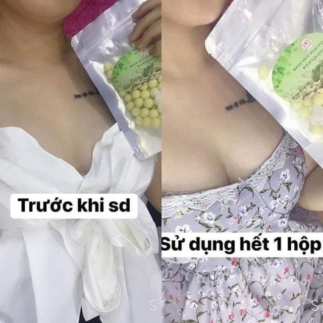 [HCM]Viên Mầm Đậu Nành Tăng Vòng 1