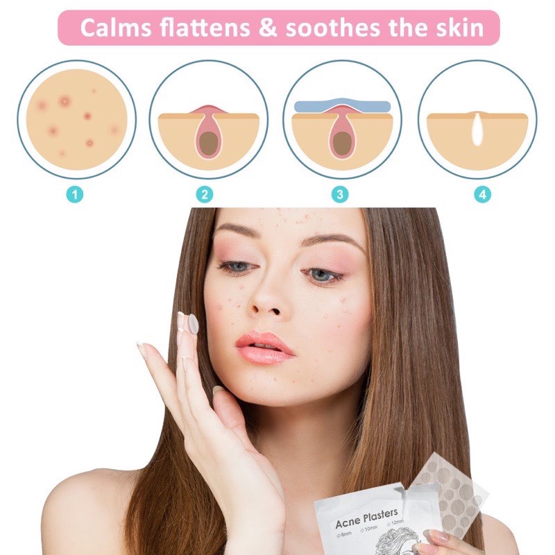 COMBO 3 BỘ 108 MIẾNG DÁN CHE MỤN, CHE KHUYẾT ĐIỂM THOÁNG KHÍ