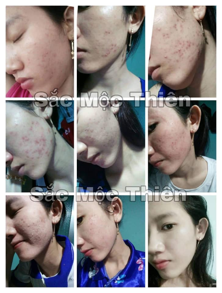 [HCM]Linh Chi Bột rửa mặt Sắc Mộc Thiên 90GR