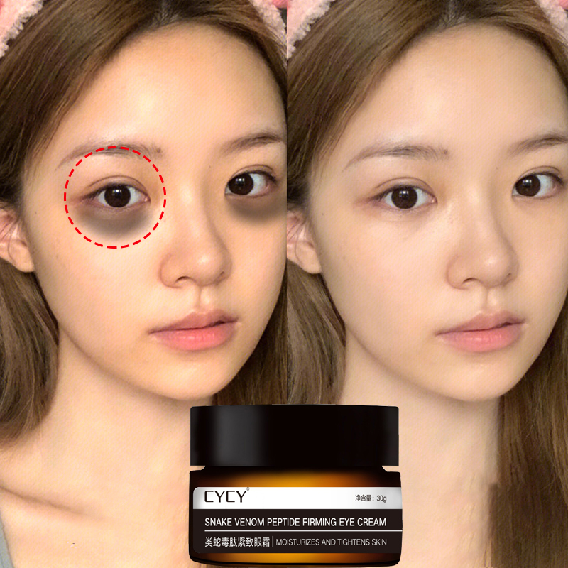 kem chống nhăn vùng mắt Loại bỏ quầng thâm mắt Tác dụng nhanh 5 giây 30g