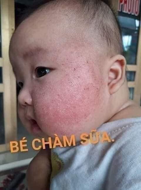 { HÀNG XÁCH TAY NGA CHÍNH HÃNG } - Kem bôi ngứa belosalic