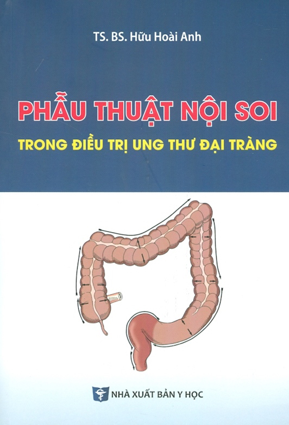 Phẫu thuật nọi soi trong điều trị ung thư đại tràng