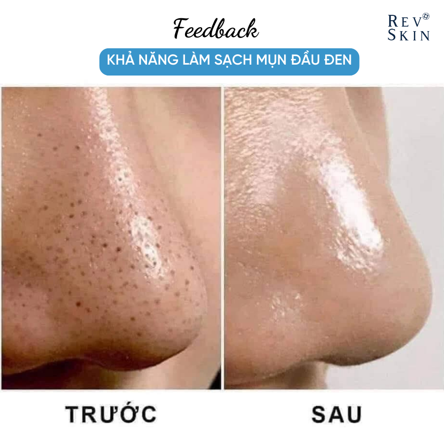 Combo Sạch Mụn RevSkin - Sữa Rửa Mặt + Kem Chấm Mụn