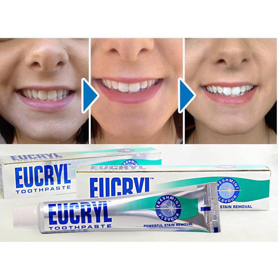 [HCM]Kem đánh răng Eucryl Freshmint Toothpaste 62g