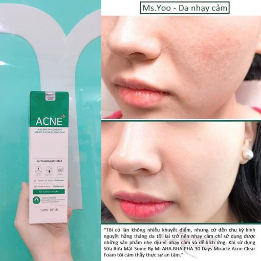 Sữa Rửa Mặt Some By Mi Clear Foam 100ml