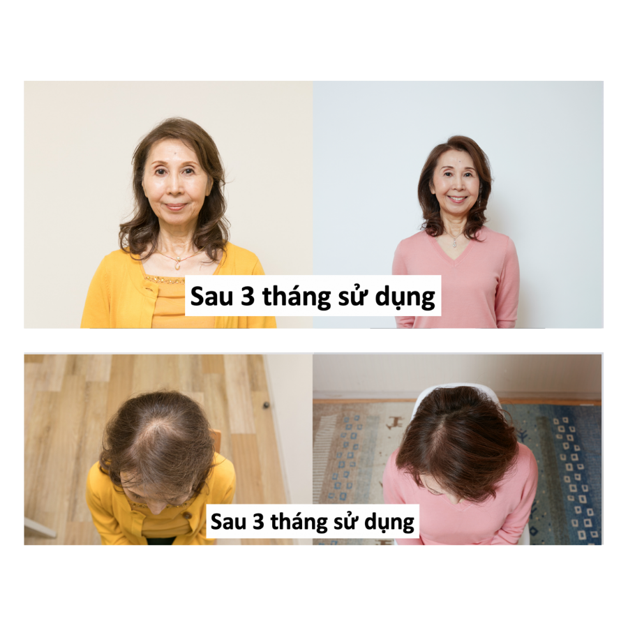 Xịt dưỡng tóc kích thích mọc tóc Nhật Bản Newmo 75ML