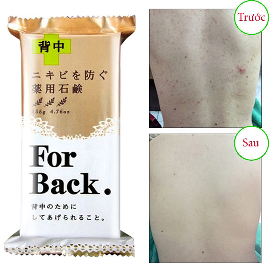 Xà phòng giảm mụn lưng For back của Nhật
