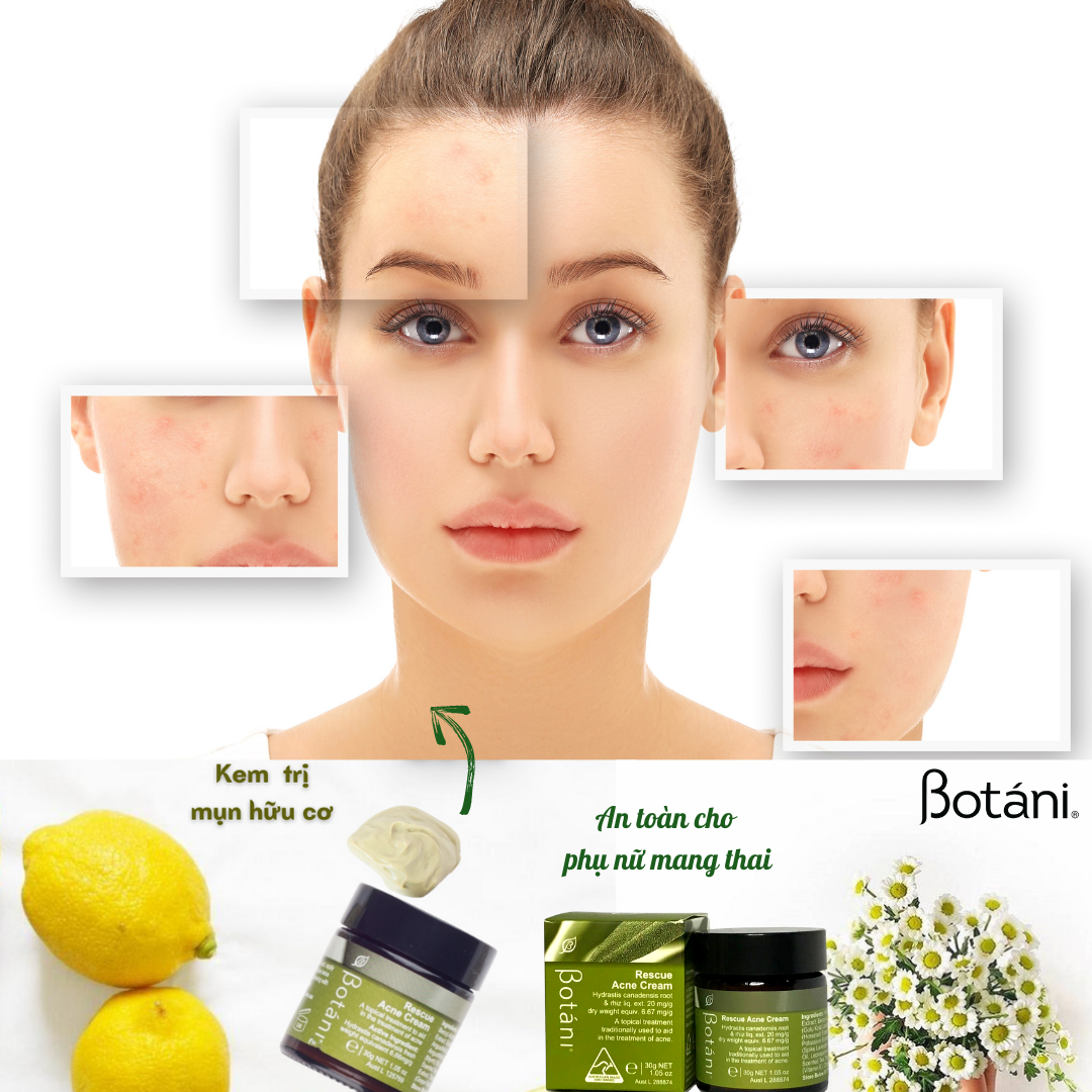 Kem Mụn Hữu Cơ – Rescue Ance Cream (30g)