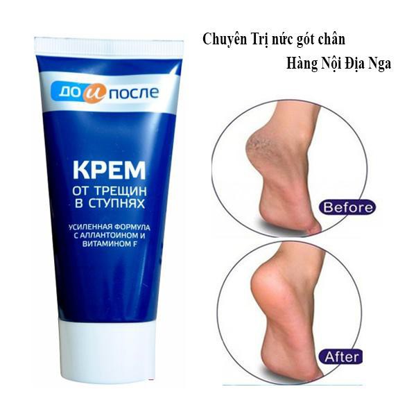 [HCM]Kem Trị Nứt Gót Chân Hàng Nga