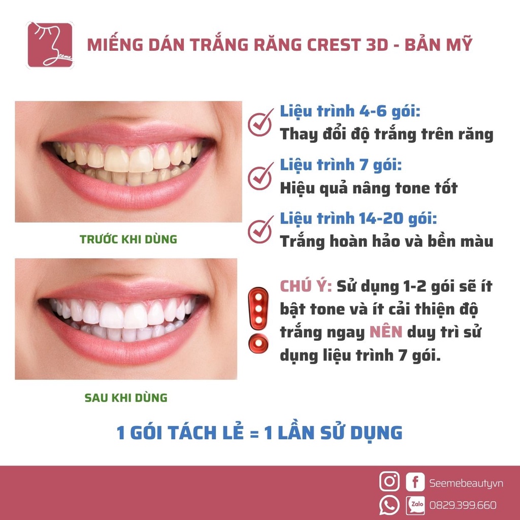 [HOÀN TIỀN 15%] [Bill Mỹ] Miếng Dán Trắng Răng Crest 3D White Glamorous - Professional - 1 Hour - Charcoal [SeeMe beauty]