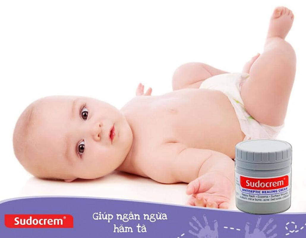 KEM CHỐNG HĂM CHO BÉ SUDOCREM 60g
