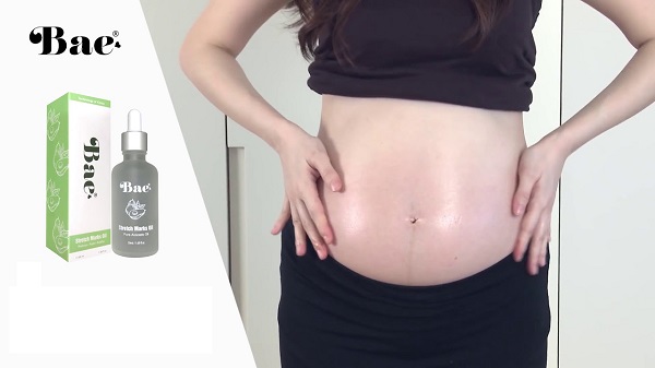 [HCM]Tinh Dầu ngăn ngừa rạn da cho bà bầu