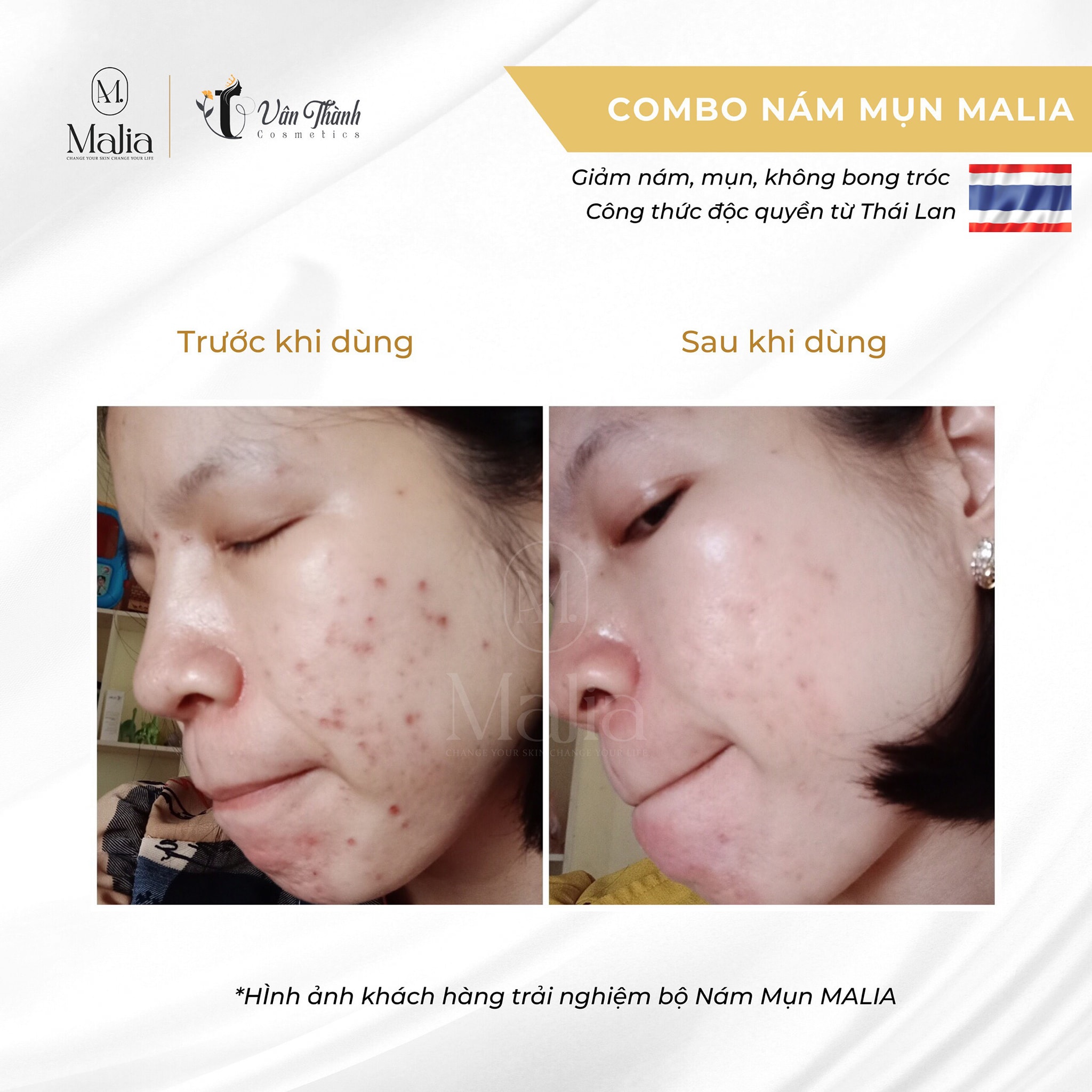 Dưỡng da cao cấp Thái Lan (Full size) Malia - Mẫu mới 2022