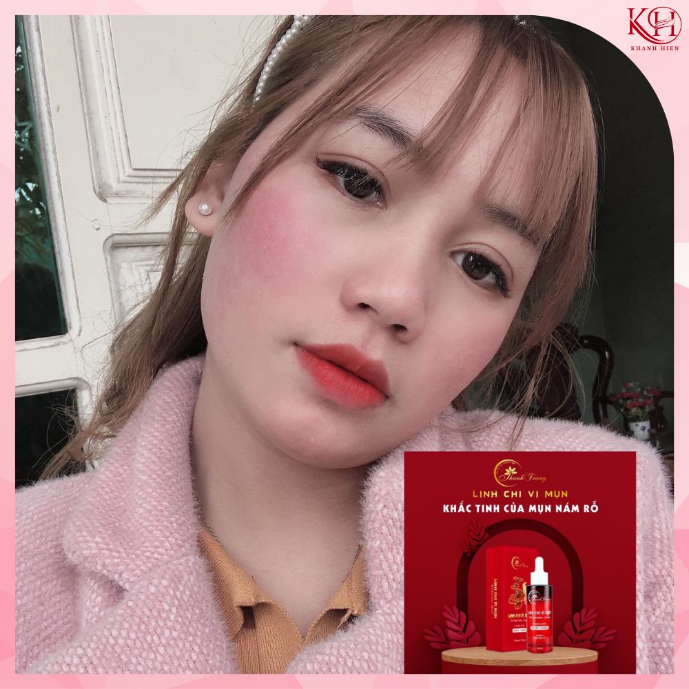 [HCM]Linh Chi Vi Mụn Tái Tạo Da Cấp Tốc Thanh Trang