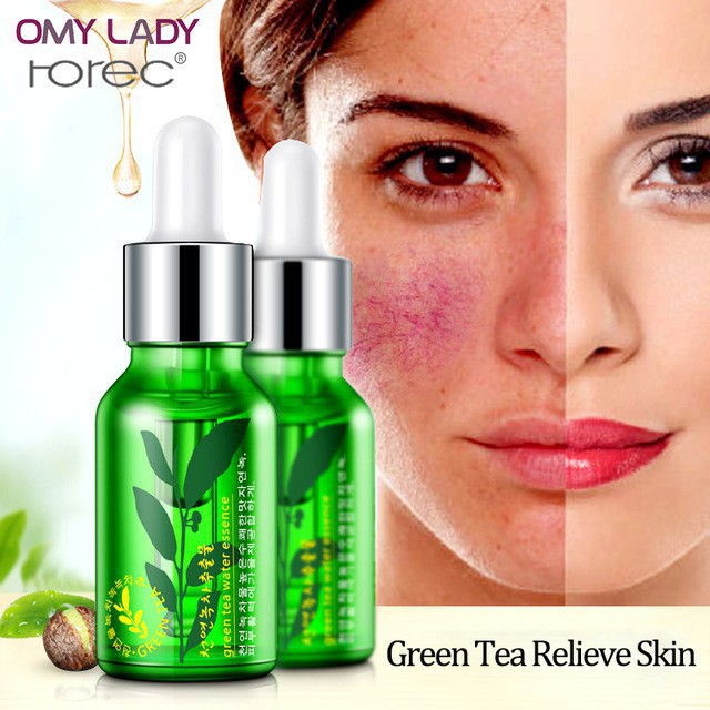 Serum dưỡng da mụn trà xanh Rorec 15ml