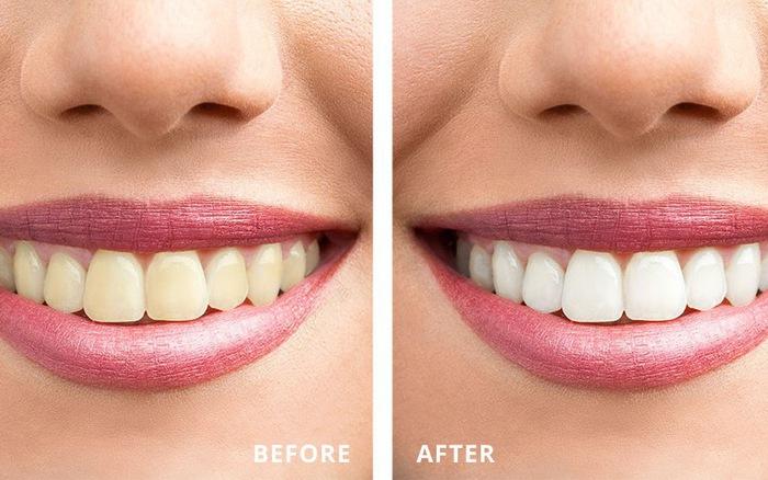 KEM ĐÁNH RĂNG COLGATE CAVITY PROTECTION 70G
