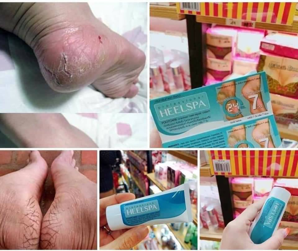 Kem Bôi Nứt Gót Chân HEELSPA Thái Lan