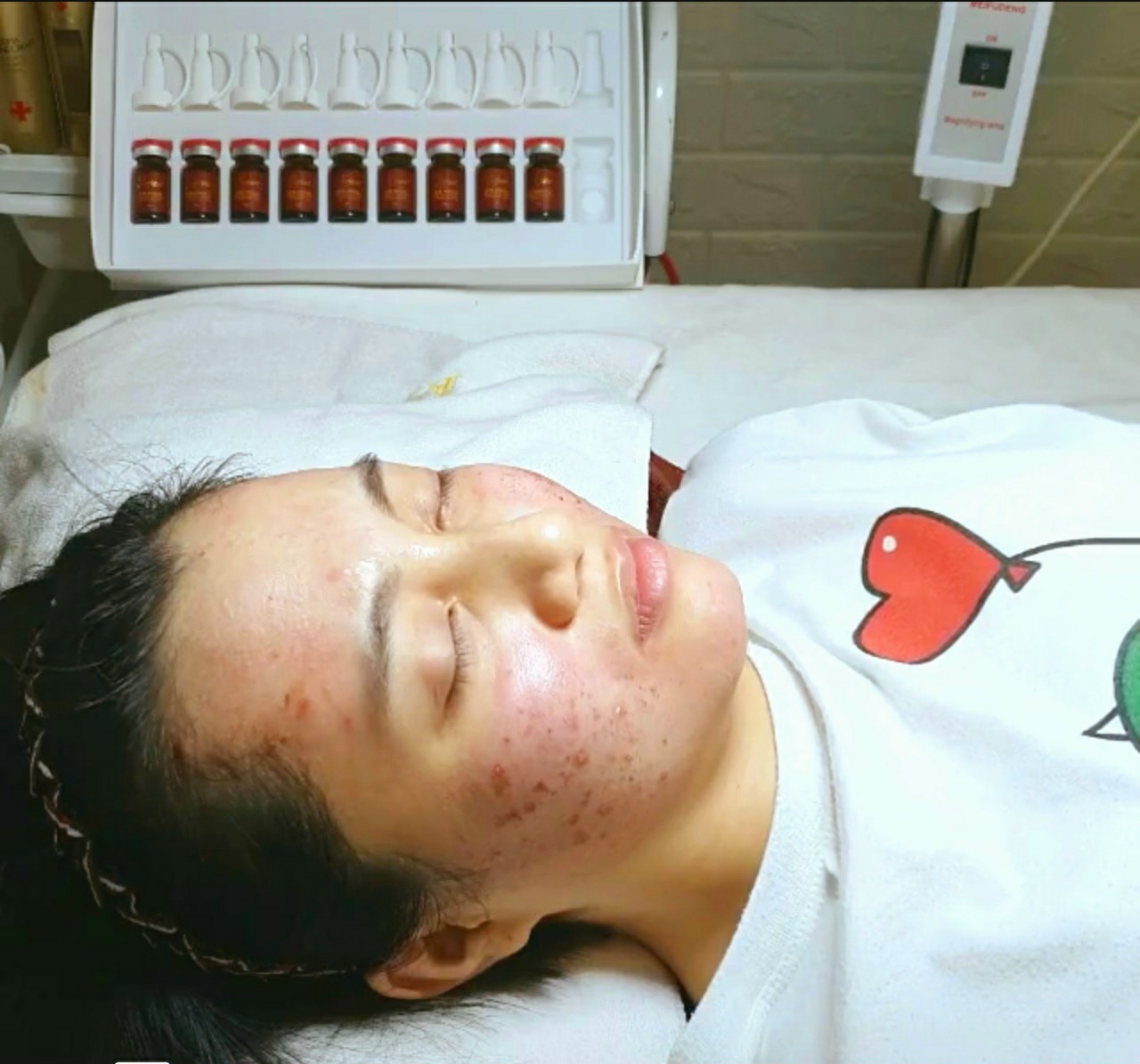 Serum Trị Mụn Thâm - Retinol/AHA/BHA DNA Cá Hồi