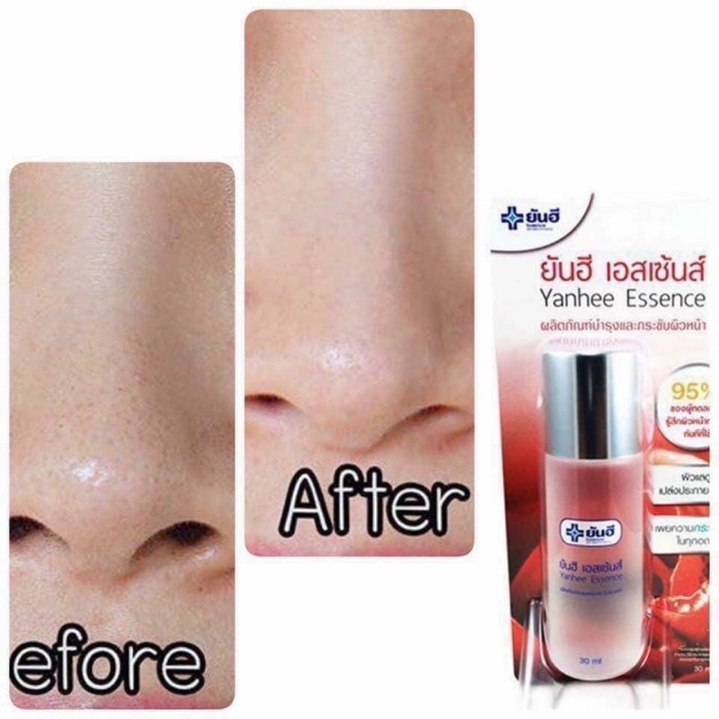 Nước hoa hồng bệnh viện yanhee thái lan